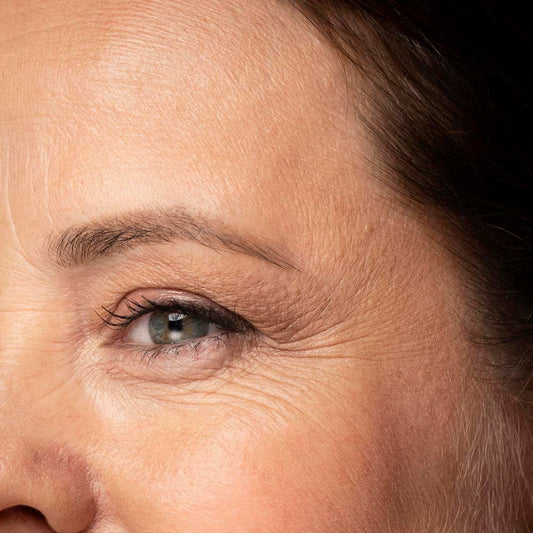 fine lines under eyes