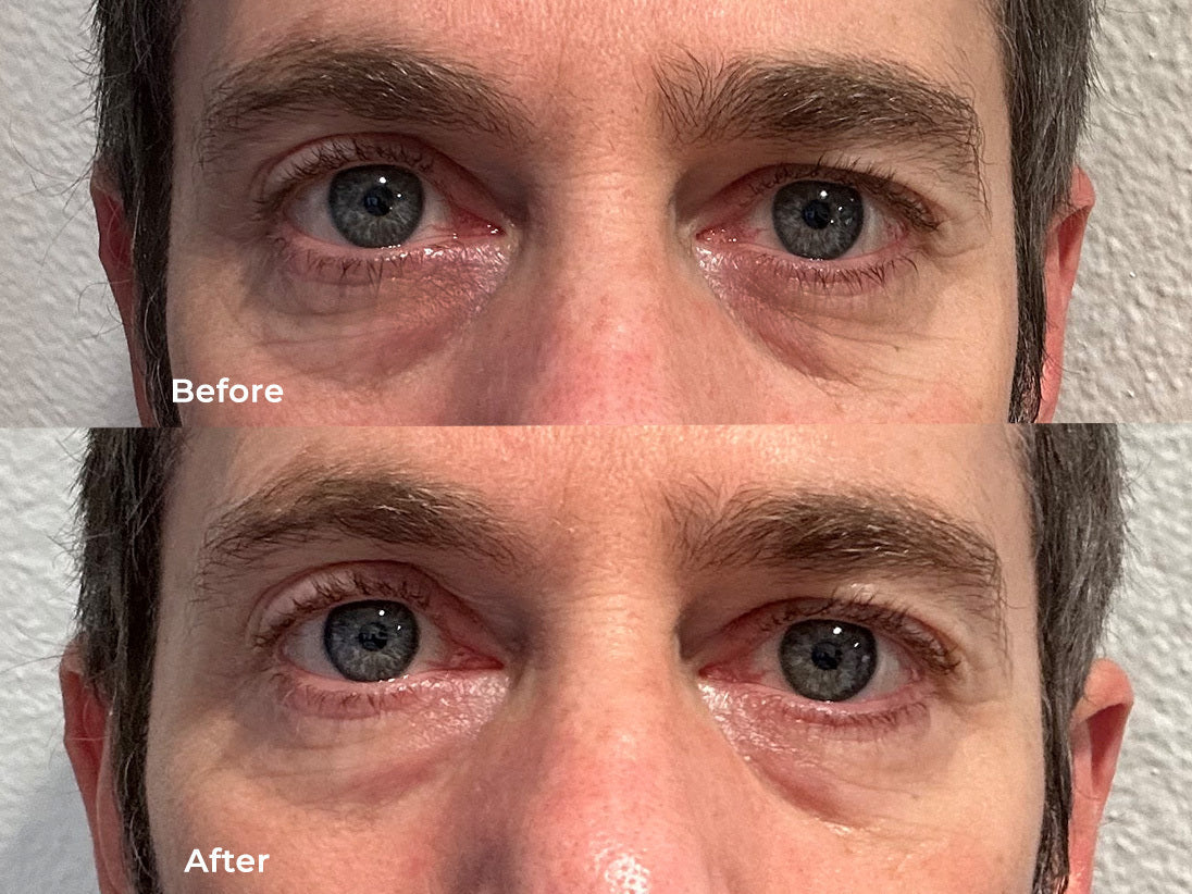 Yerba Mate Radiance Eye Cream