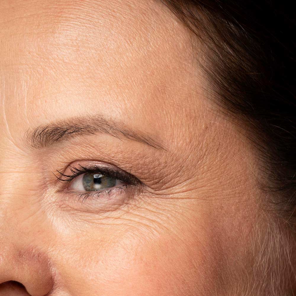 fine lines under eyes