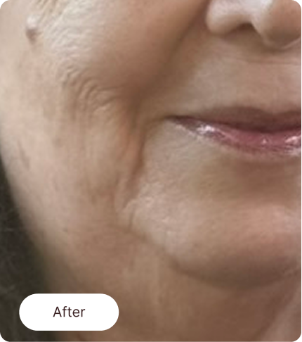 Night revival cream after