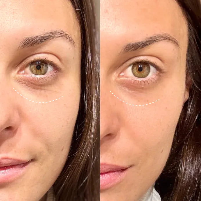 The biomimetic before and after