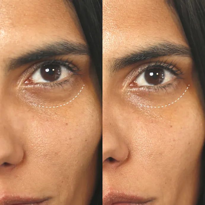 Before and after eye cream image