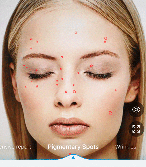 Your Skin, Decoded: Personalized Skin Insight Powered by AI – Infuse